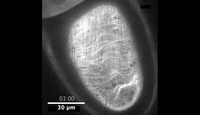 image of Cytoplasmic Streaming in the Drosophila Oocyte: Video 3